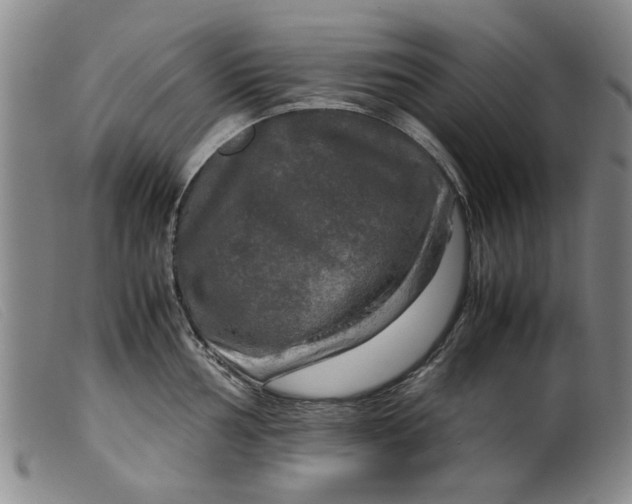 X0000099411002200805231600