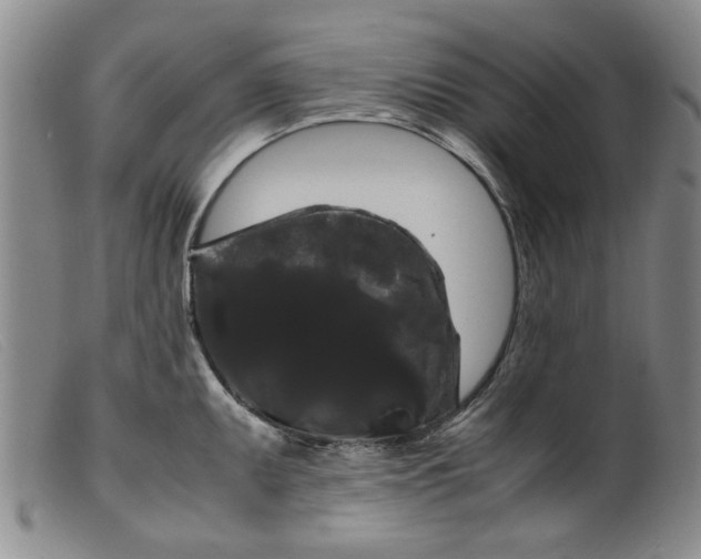 X0000099411095200805231558