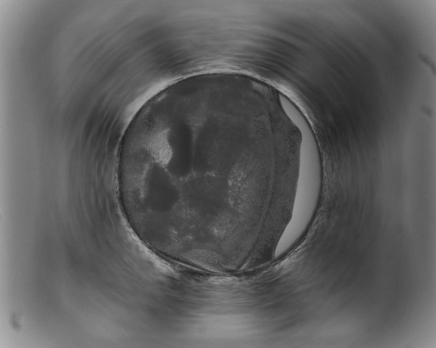 X0000099411142200805231558