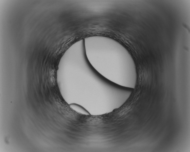 X0000099411156200805231557