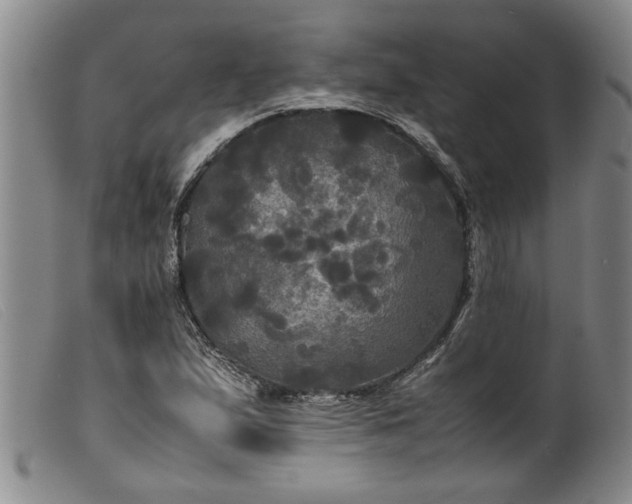 X0000099411167200805231557