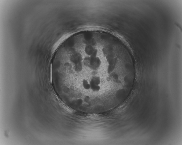 X0000099411175200805231557