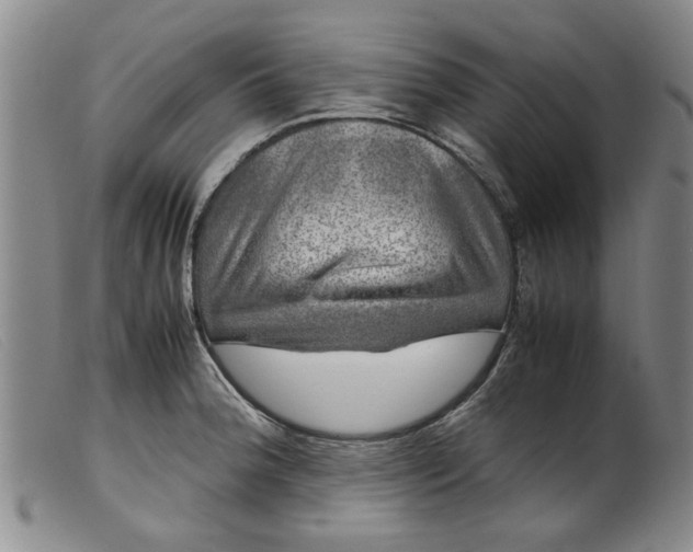 X0000099411188200805231556