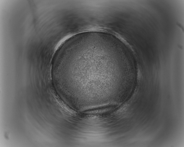 X0000099411222200805231556