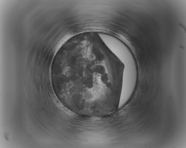 X0000099411283200805231555