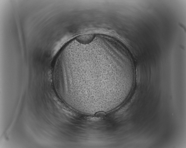 X0000099411501200805231551