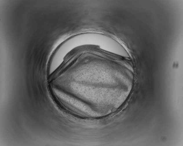 X0000099410008200805301356