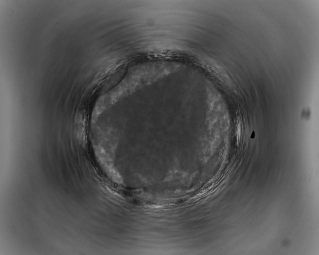 X0000099411060200805301341