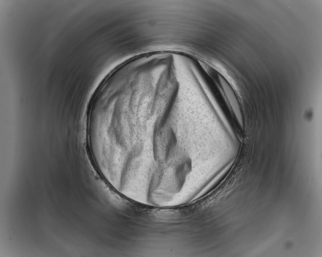 X0000099411140200805301340