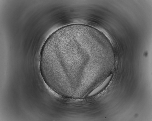 X0000099411143200805301340