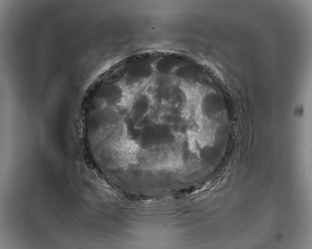 X0000099411159200805301339