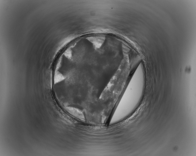 X0000099411171200805301339