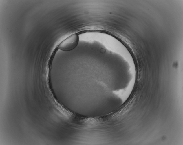 X0000099411179200805301339