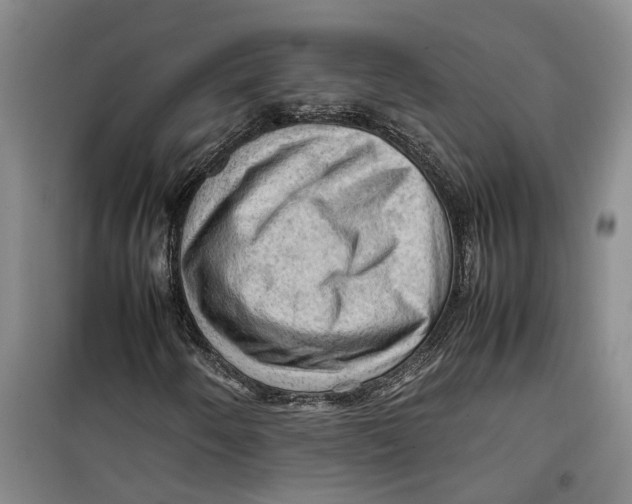 X0000099411250200805301338