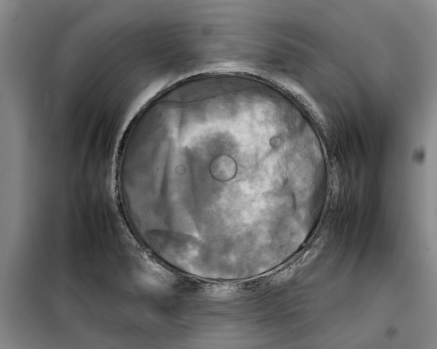 X0000099411278200805301338