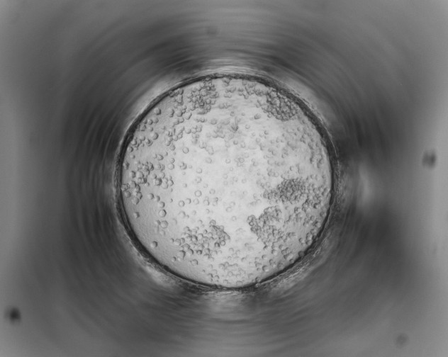 X0000099411282200805301338