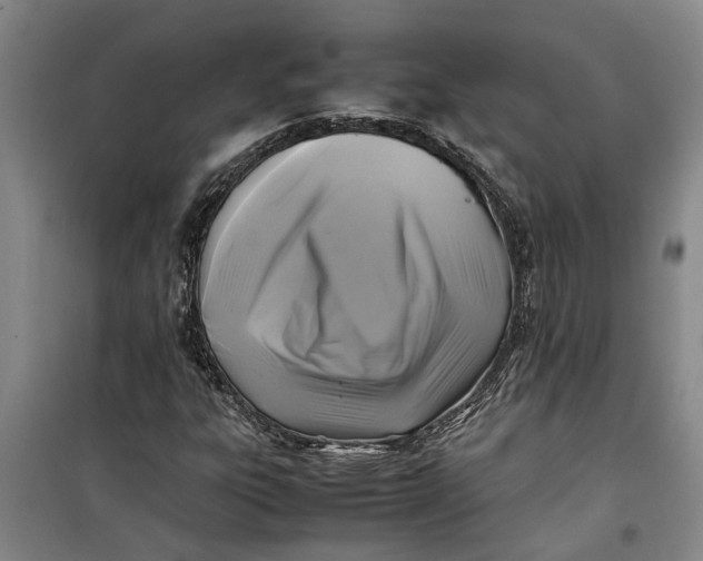 X0000099411303200805301337