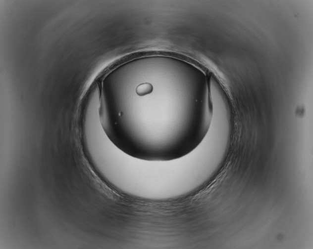 X0000099411368200805301336