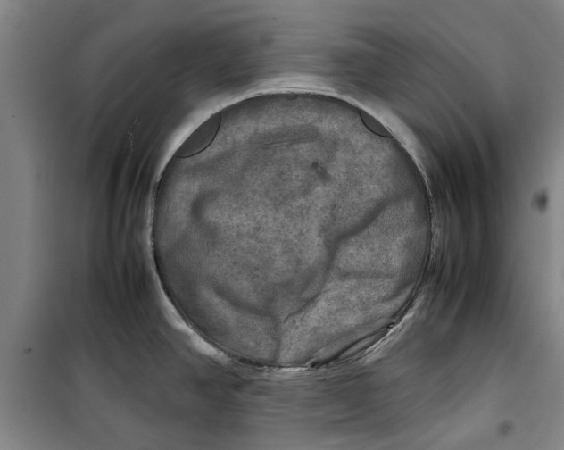 X0000099411390200805301336