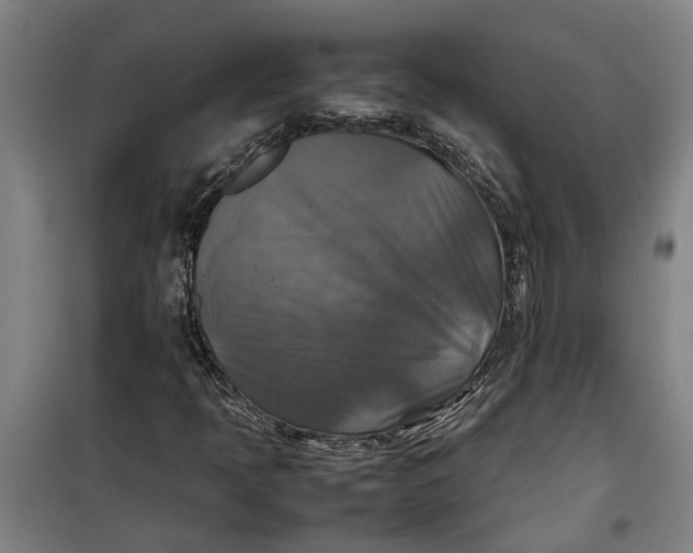 X0000099411397200805301335