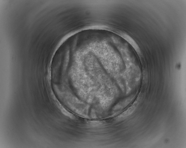 X0000099411436200805301336