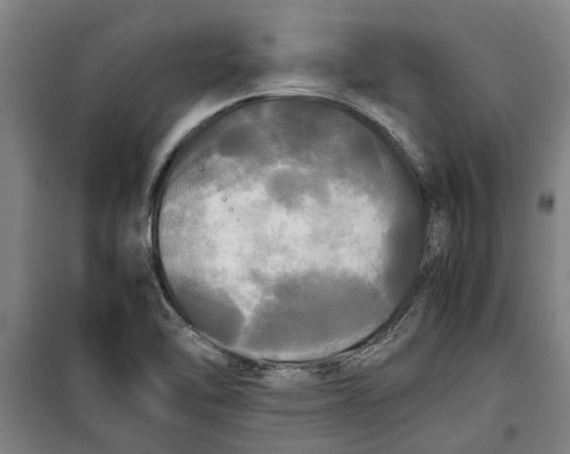 X0000099411462200805301335