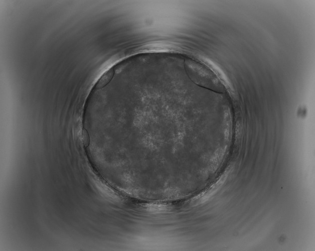 X0000099411465200805301335