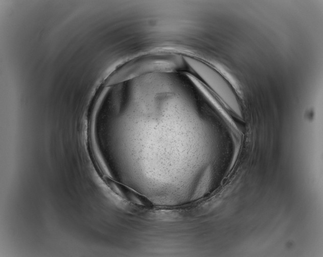 X0000099411476200805301335