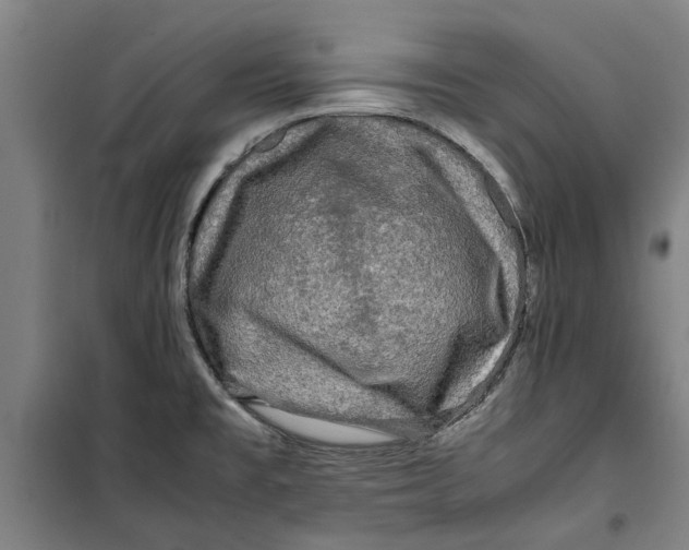 X0000099411477200805301335