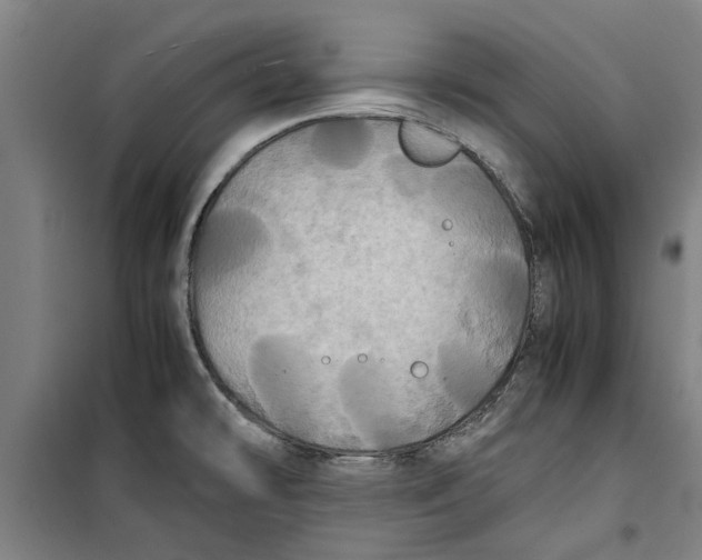 X0000099411478200805301335