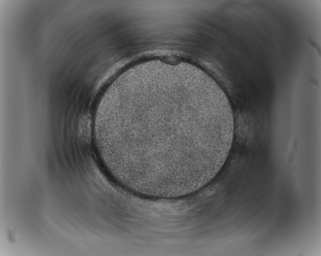 X0000099410016200806060942