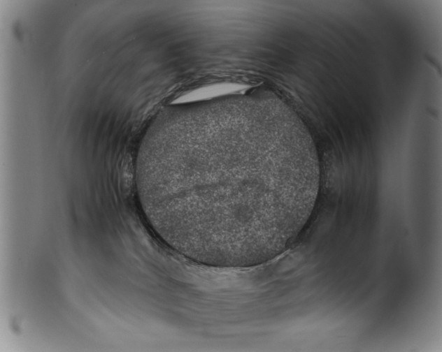 X0000099410040200806060942