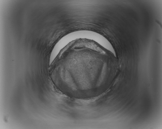 X0000099410041200806060942