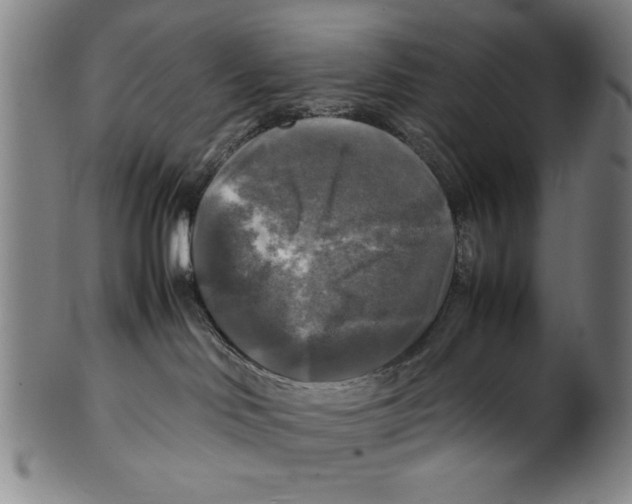 X0000099410046200806060942