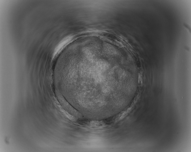 X0000099410101200806060941