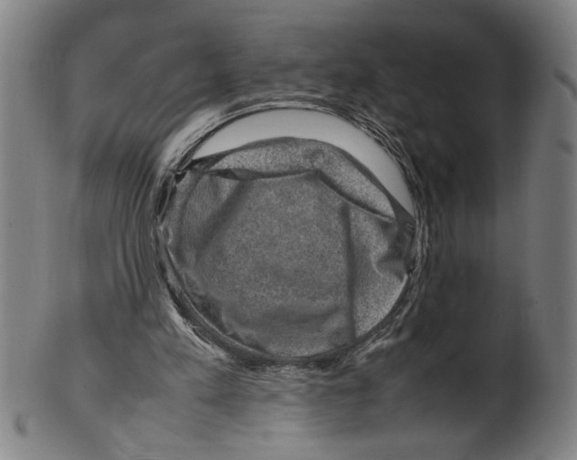 X0000099410197200806060939