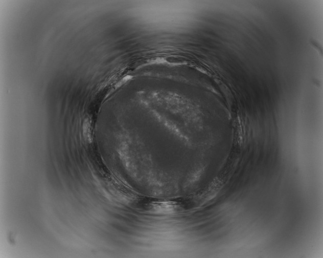 X0000099410316200806060938