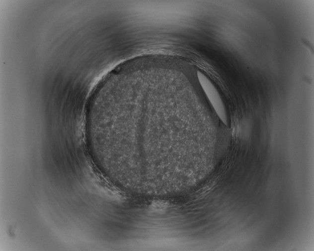 X0000099410388200806060937