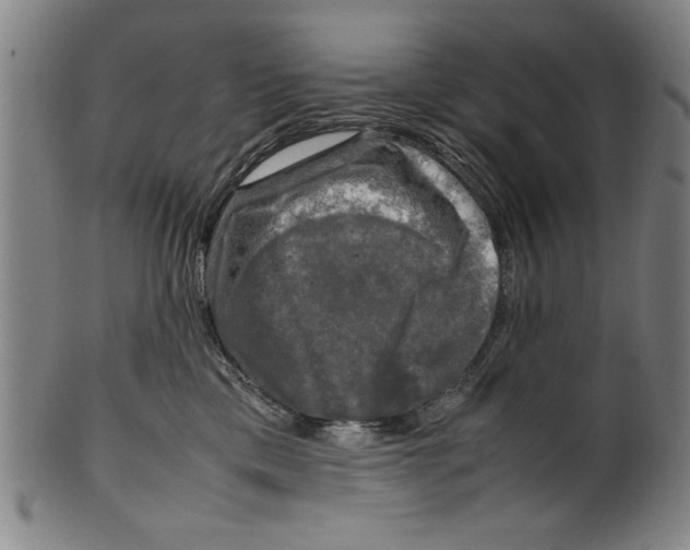 X0000099410425200806060936