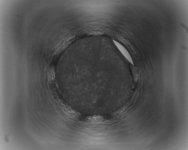 X0000099410517200806060935