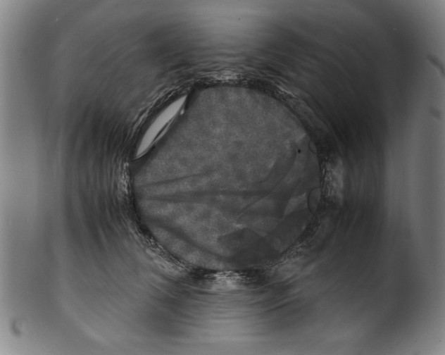 X0000099410612200806060933