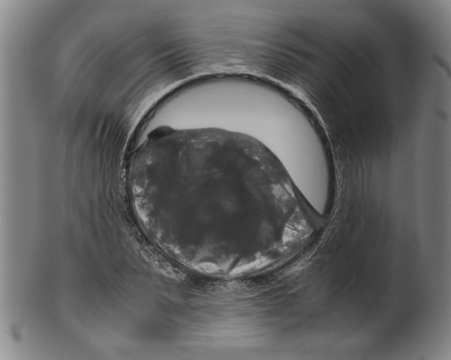 X0000099410879200806060929