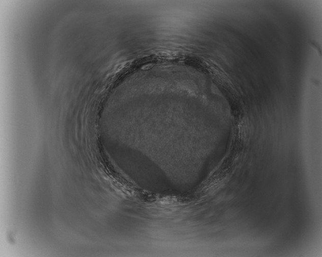 X0000099410961200806060928