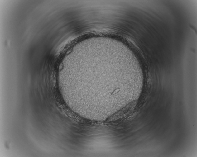 X0000099411016200806060926