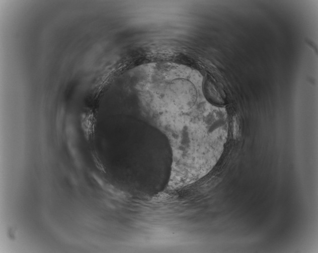 X0000099411059200806060926