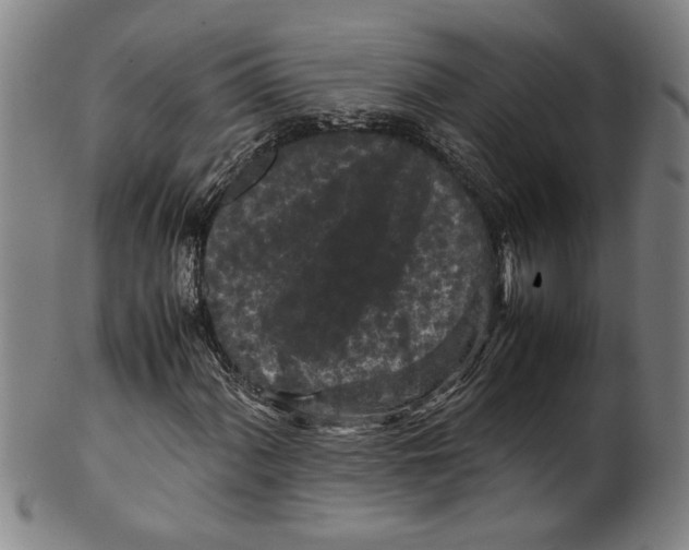 X0000099411060200806060926