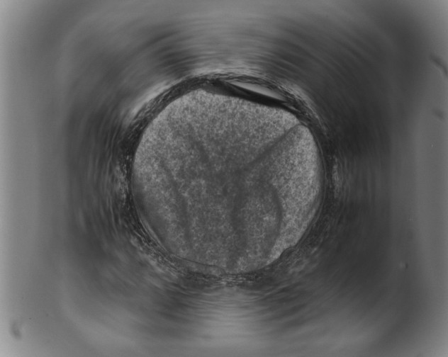 X0000099411064200806060926