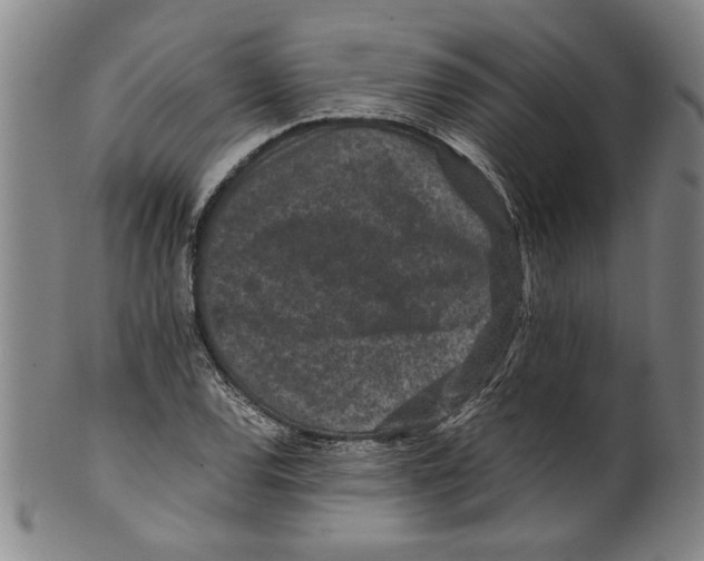 X0000099411120200806060925