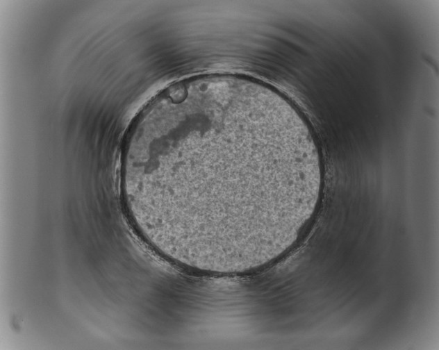 X0000099411126200806060925