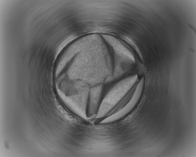 X0000099411138200806060925